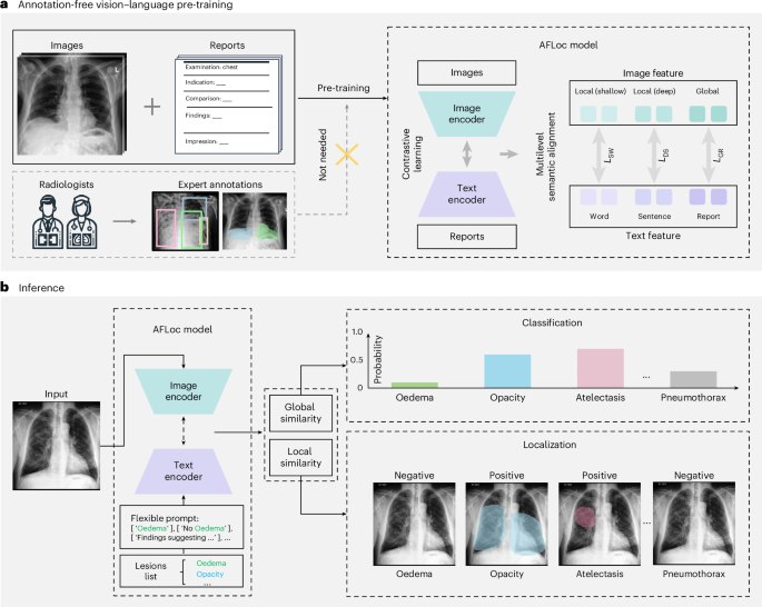 中国团队开发 AFLoc 模型，实现无标注病理定位技术突破中国科研团队开发出一种名为 AFLoc 的多模态视觉语言模型，可在无需专家标注的情况下实现病理定位