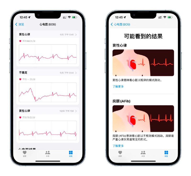 iOS 15.2 RC 版推送，国行 Apple Watch 心电图终于来了今天苹果发布了 iOS 15.2 RC 版，也就是候选版，不出意外的话下周 iOS 15.2 正式版就将到来，两者版本号相同