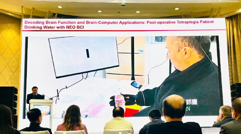 上海首例脑机接口手术进展 瘫痪患者已实现“意念”喝水 采用术中功能定位技术大幅缩短手术时间在世界脑机接口联合会议上，复旦大学附属华山医院院长、国家神经疾病医学中心主任毛颖教授披露了这例手术的进展