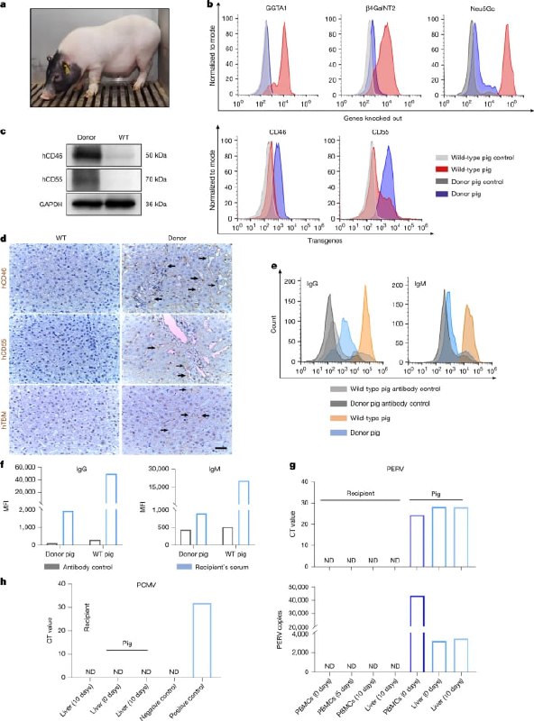 世界首例基因编辑猪肝移植人体成功 为器官短缺提供突破性方案中科院院士窦科峰团队利用经6处基因编辑的猪肝脏，移植至一名脑死亡但体征稳定的患者体内，同时保留其自身肝脏以模拟肝衰竭支持治疗